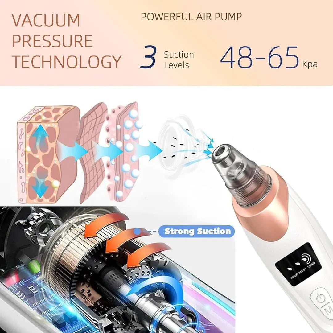 5-in-1 Electric Blackhead Remover USB Rechargeable