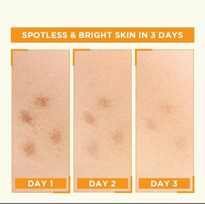 Garnier Skin Naturals Vitamin C Serum 30ml Brightening Spot Lightener
