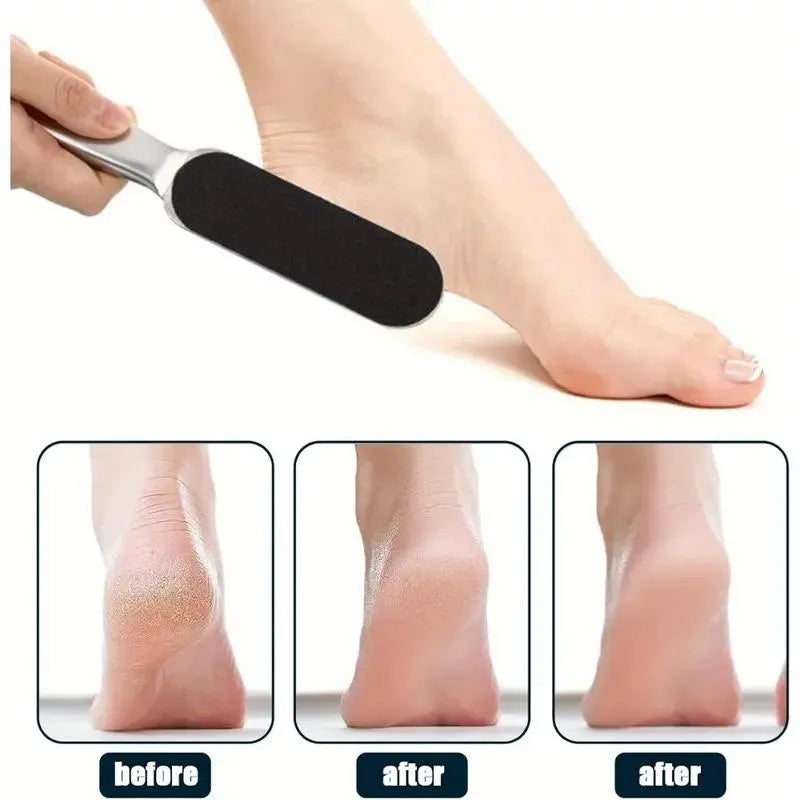 Stainless Steel Foot Filer for Dead Skin Removal