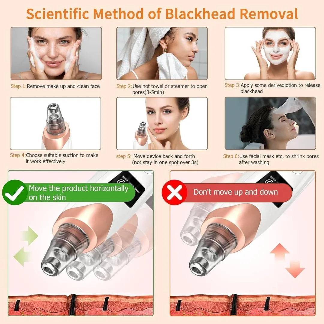 5-in-1 Electric Blackhead Remover USB Rechargeable