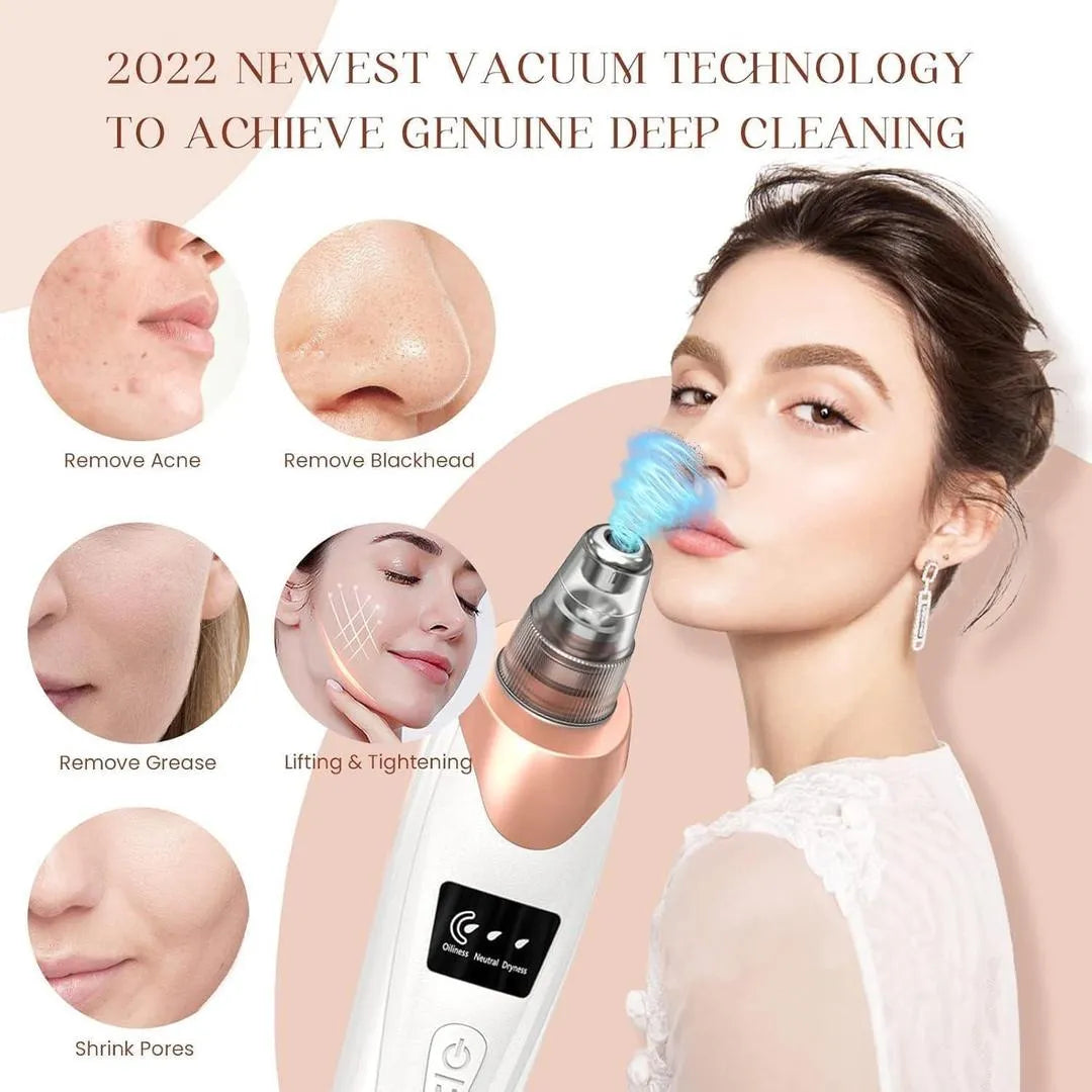 5-in-1 Electric Blackhead Remover USB Rechargeable